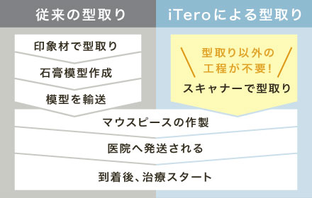 iTeroによる型取りは型取り以外の工程が不要！スキャナーで型取り