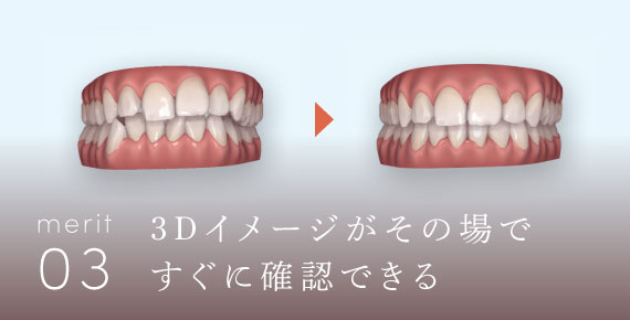 3Dイメージがその場ですぐに確認できる