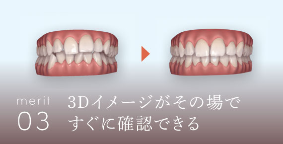 3Dイメージがその場ですぐに確認できる