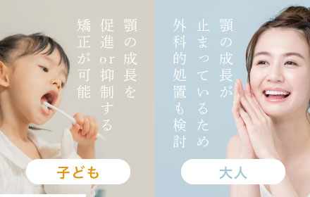 子ども：顎の成長を促進or抑制する矯正が可能 大人:顎の成長が止まっているため外科的処置も検討