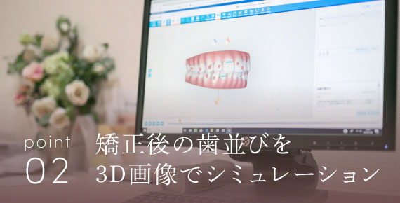 矯正後の歯並びを3D画像でシミュレーション